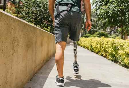 Advancing Mobility and Independence with Lower Limb Amputation Solutions Advancing Mobility and Independence with Lower Limb Amputation Solutions